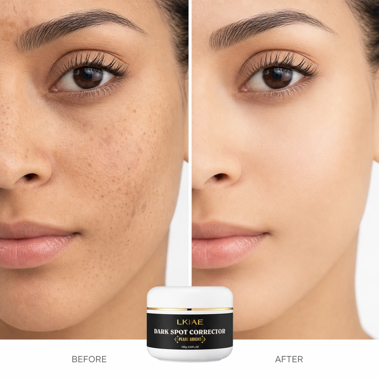Dark Spot Correction Cream - Reduce Dark Spots Naturally